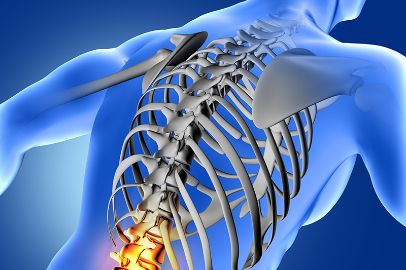 Spinal Cord & Omurilik Yaralanmaları